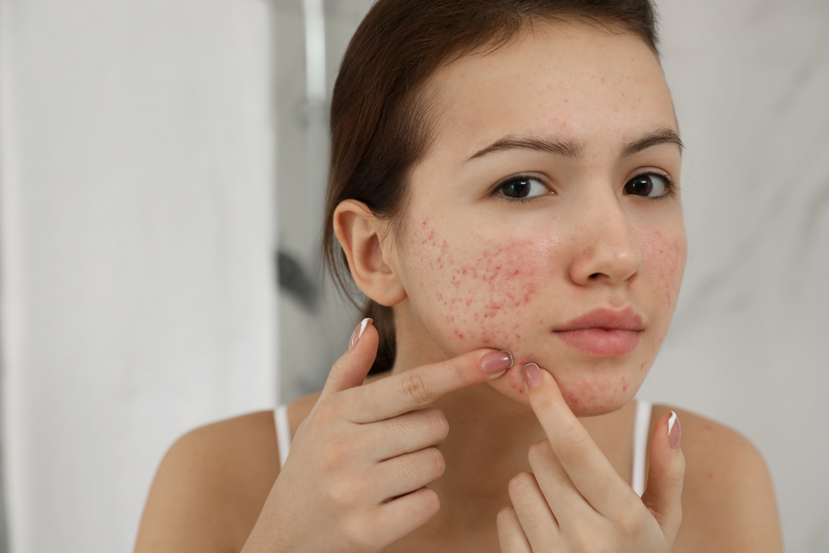 Skin Concerns