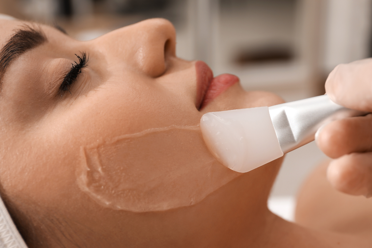 Chemical Peels