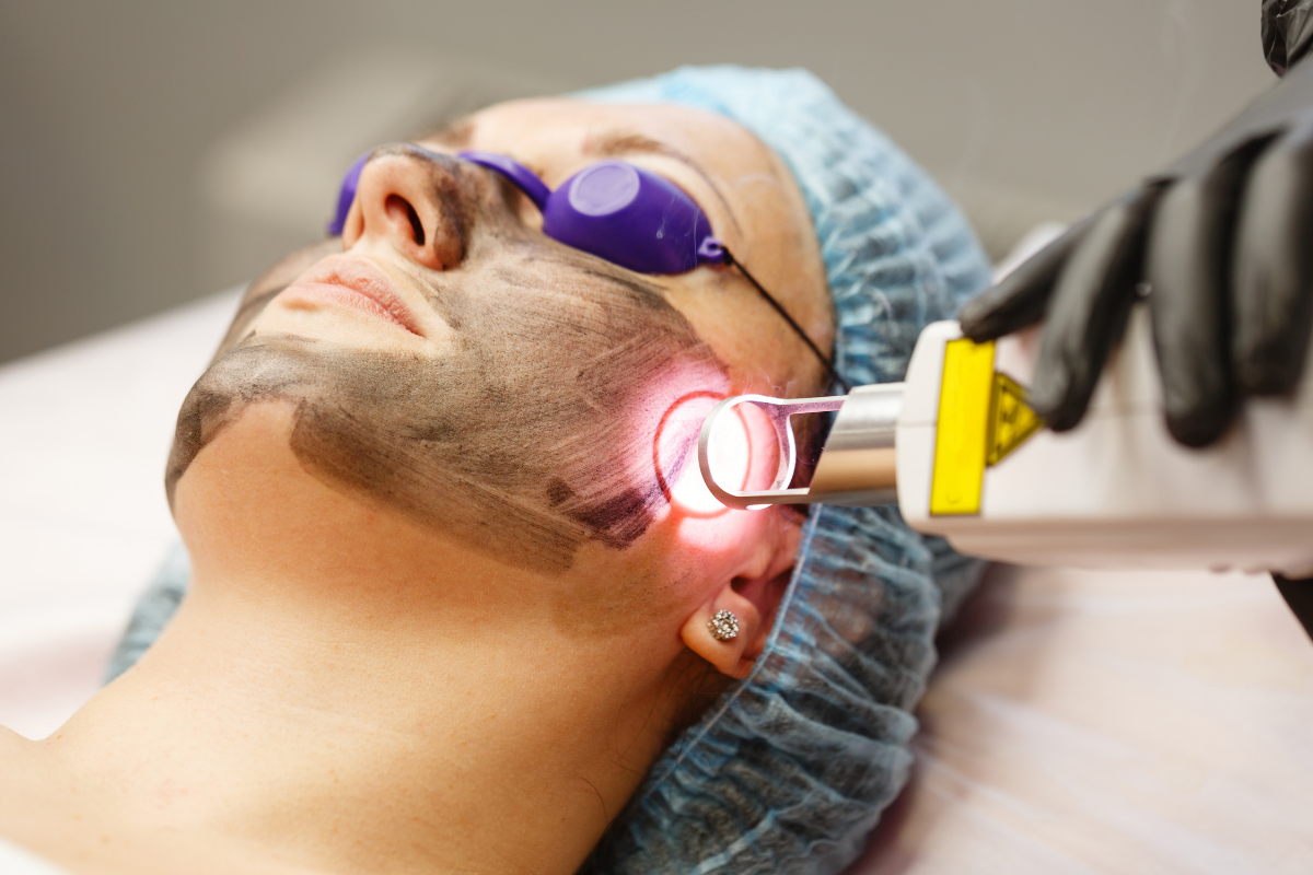 Laser & Skin Treatments