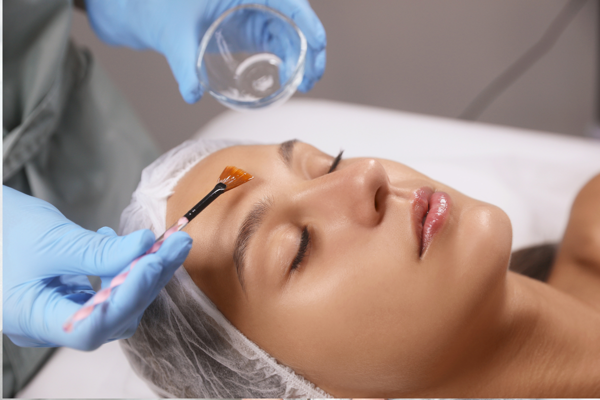 Chemical Peel for Pigmentation: What Should You Know First?